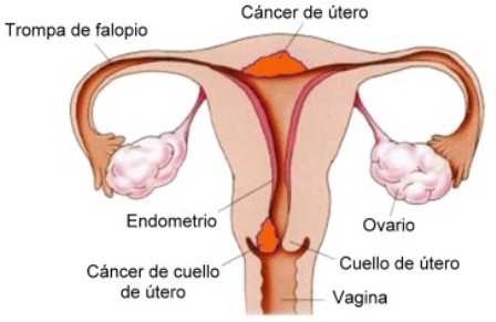 SESAU convoca mulheres para realização de exame preventivo