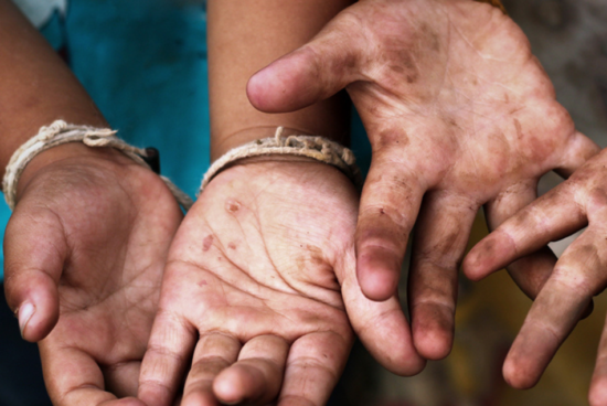 C%C3%B3pia_de_C%C3%B3pia_de_C%C3%B3pia_de_campanha_IBGE_divulgue_trabalho_infantil-550x368 Prefeitura de Alagoinhas contra o trabalho infantil; confira a programação.